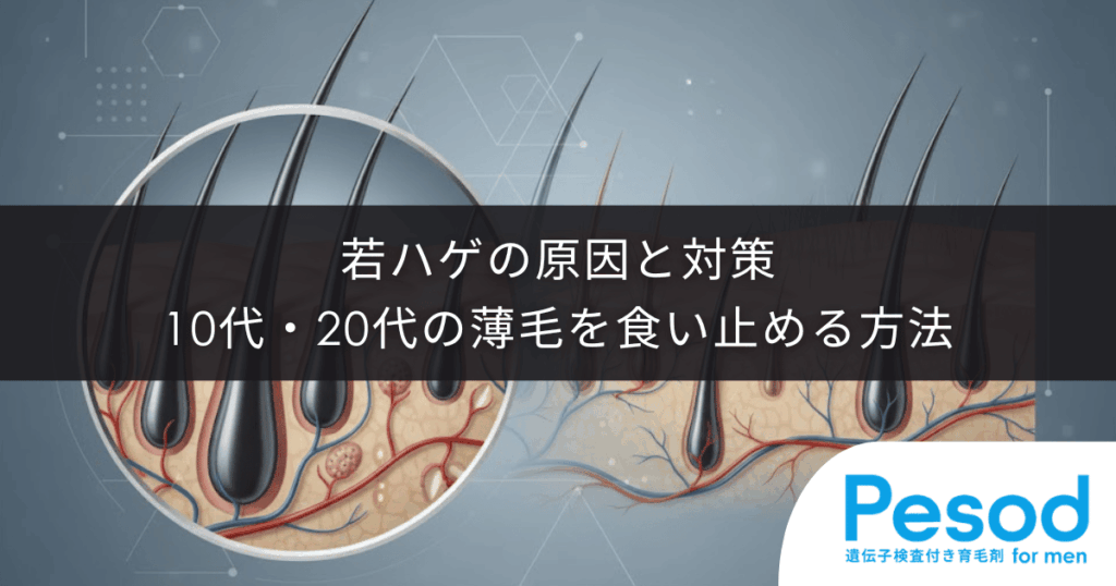 若ハゲの原因と対策｜10代・20代の薄毛を食い止める方法