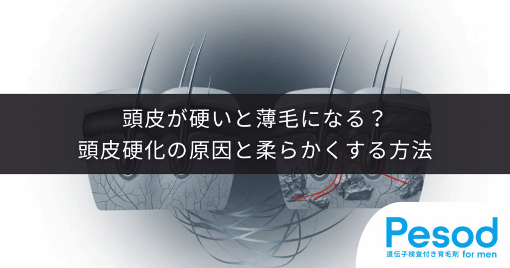 頭皮が硬いと薄毛になる？頭皮硬化の原因と柔らかくする方法