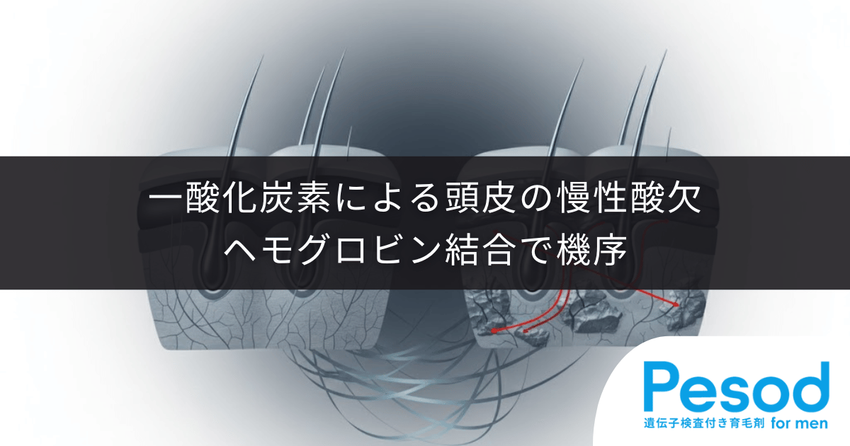 一酸化炭素による頭皮の慢性酸欠|ヘモグロビン結合で酸素が届かず毛根が窒息する機序