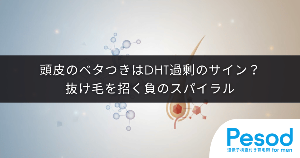 頭皮のベタつきはDHT過剰のサイン？皮脂腺を肥大化させ抜け毛を招く負のスパイラル