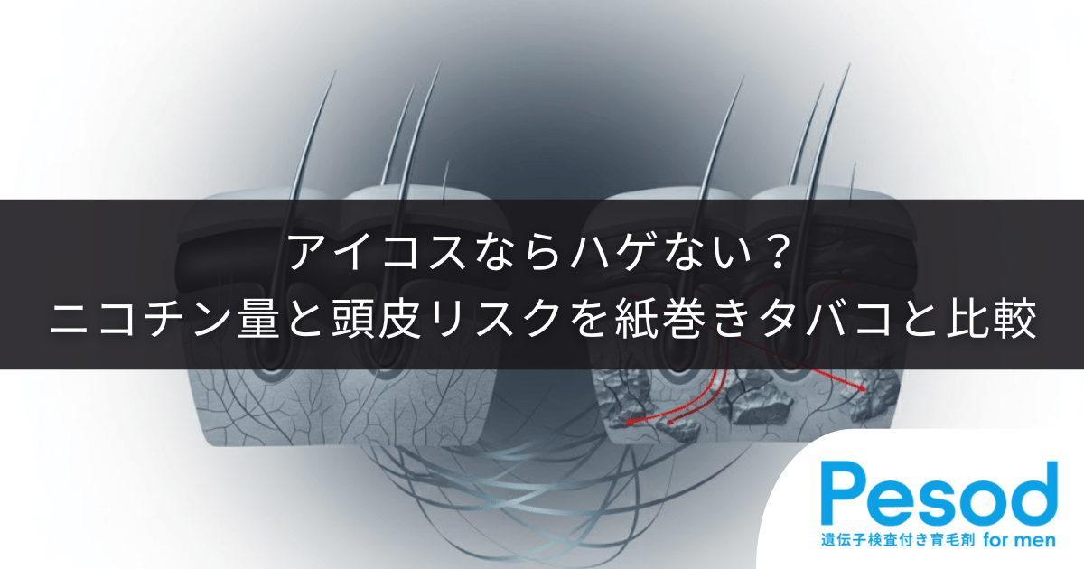 アイコス(加熱式タバコ)ならハゲない?紙巻きタバコと比較したニコチン量と頭皮リスク