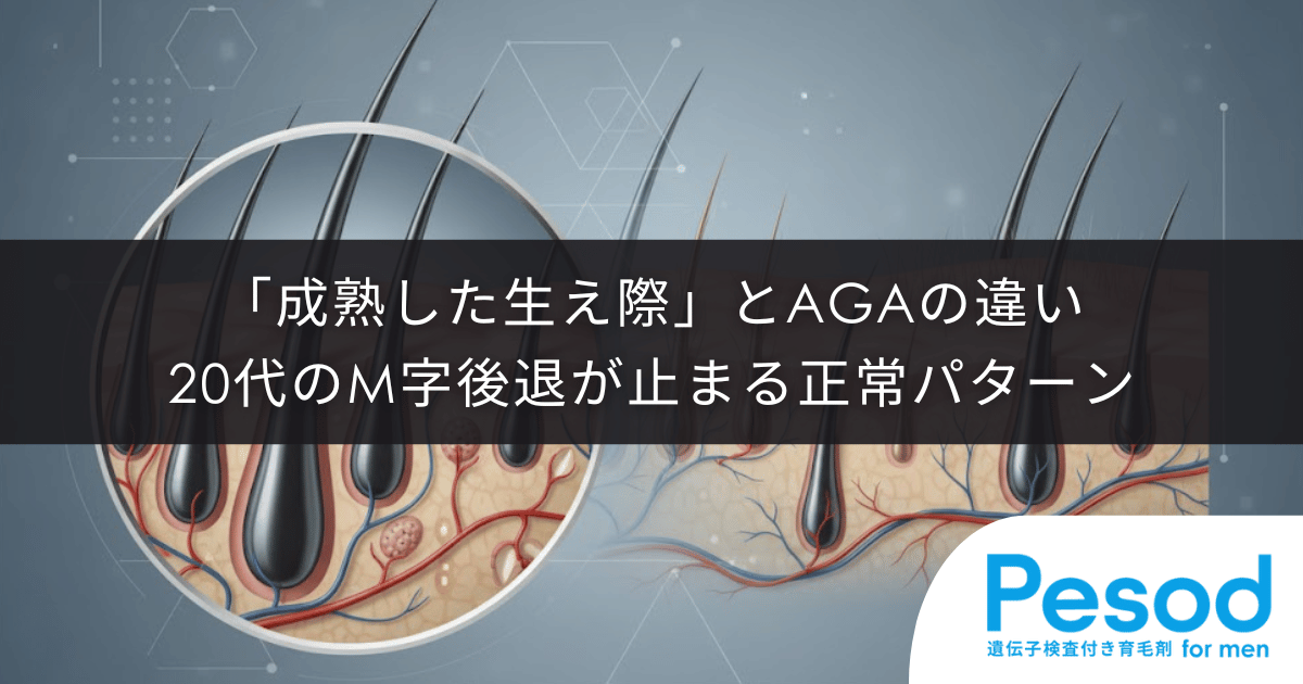 「成熟した生え際」とAGAの違い|20代のM字後退が止まる正常なパターン