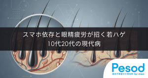 スマホ依存と眼精疲労が招く若ハゲ｜10代20代の頭皮血流が悪化する現代病