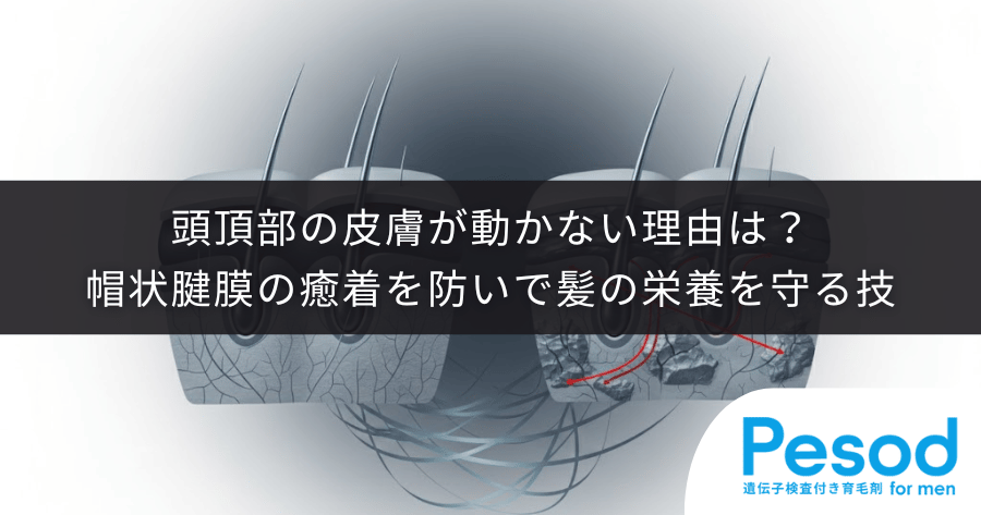 頭頂部の皮膚が動かない理由は？帽状腱膜の癒着を防いで髪の栄養を守る技