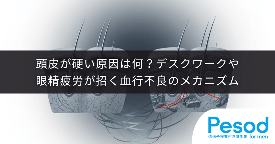 頭皮が硬い原因は何？デスクワークや眼精疲労が招く血行不良のメカニズム