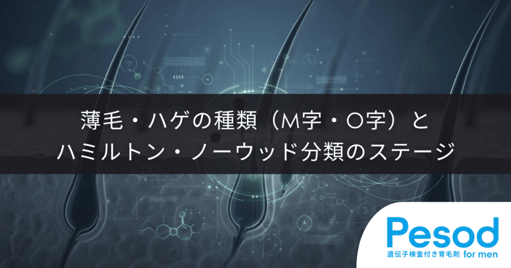 【AGAの進行レベル】薄毛・ハゲの種類（M字・O字）とハミルトン・ノーウッド分類のステージ
