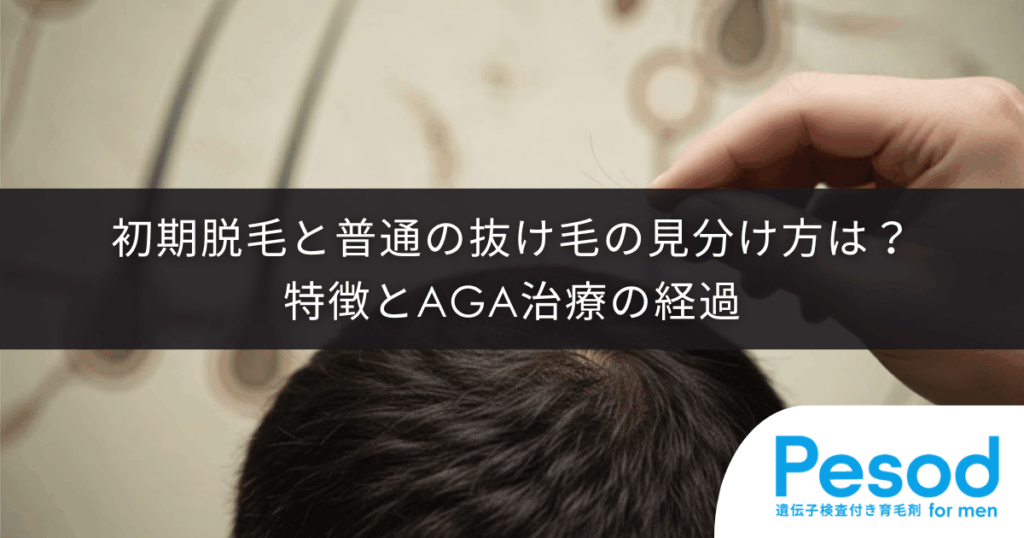 初期脱毛と普通の抜け毛の見分け方は？特徴とAGA治療の経過