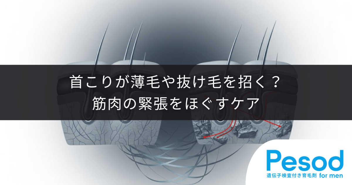 【頭皮の硬さと肩こり】首こりが薄毛や抜け毛を招く？筋肉の緊張をほぐすケア