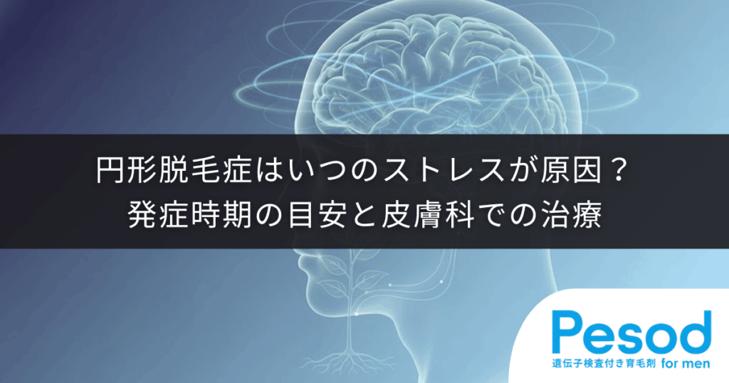 円形脱毛症はいつのストレスが原因？発症時期の目安と皮膚科での治療