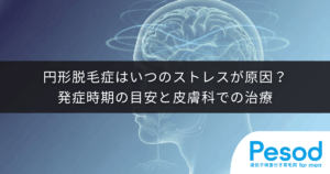 円形脱毛症はいつのストレスが原因？発症時期の目安と皮膚科での治療