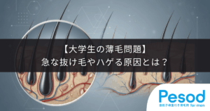 【大学生の薄毛問題】急な抜け毛やハゲる原因とは？手遅れになる前の対策と皮膚科受診