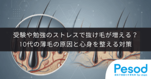 受験や勉強のストレスで抜け毛が増える？10代の薄毛の原因と心身を整える対策