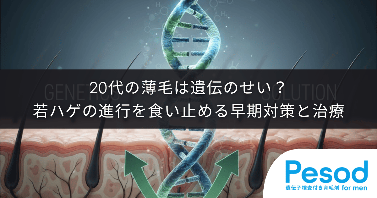 20代の薄毛は遺伝のせい？若ハゲの進行を食い止める早期対策と皮膚科・専門クリニックでの治療
