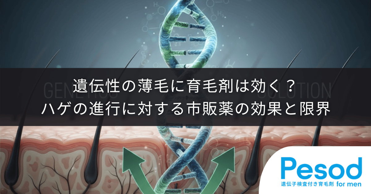 遺伝性の薄毛に育毛剤は効く？ハゲの進行に対する市販薬の効果と限界・処方薬との違い