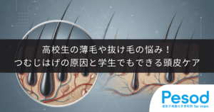 高校生の薄毛や抜け毛の悩み！つむじはげの原因と学生でもできる正しい頭皮ケア