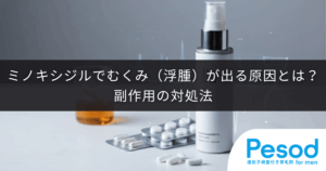 ミノキシジルでむくみ（浮腫）が出る原因とは？副作用の対処法