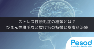 ストレス性脱毛症の種類とは？びまん性脱毛など抜け毛の特徴と皮膚科治療