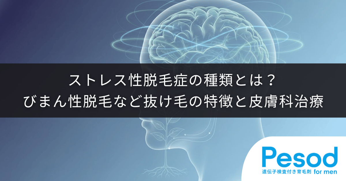 ストレス性脱毛症の種類とは？びまん性脱毛など抜け毛の特徴と皮膚科治療