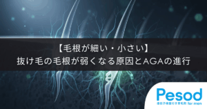 【毛根が細い・小さい】抜け毛の毛根が弱くなる原因とAGA（男性型脱毛症）の進行