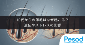 【若ハゲ・若年性脱毛症の原因】10代からの薄毛はなぜ起こる？遺伝やストレスの影響