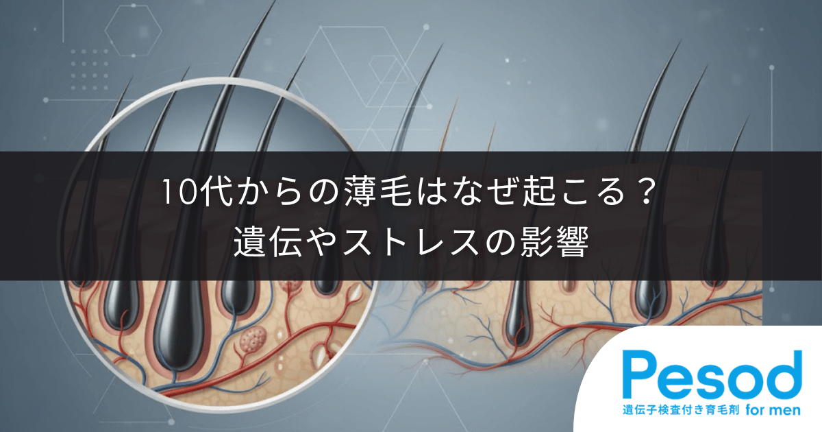 【若ハゲ・若年性脱毛症の原因】10代からの薄毛はなぜ起こる？遺伝やストレスの影響