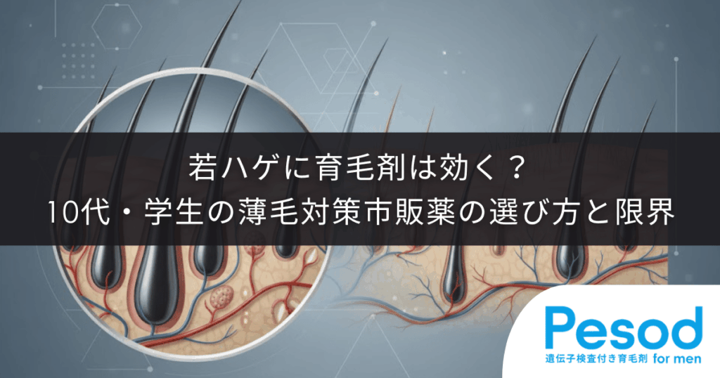 若ハゲに育毛剤は効く？10代・学生の薄毛対策における市販薬の選び方と限界