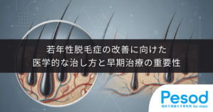 若ハゲは治る？若年性脱毛症の改善に向けた医学的な治し方と早期治療の重要性
