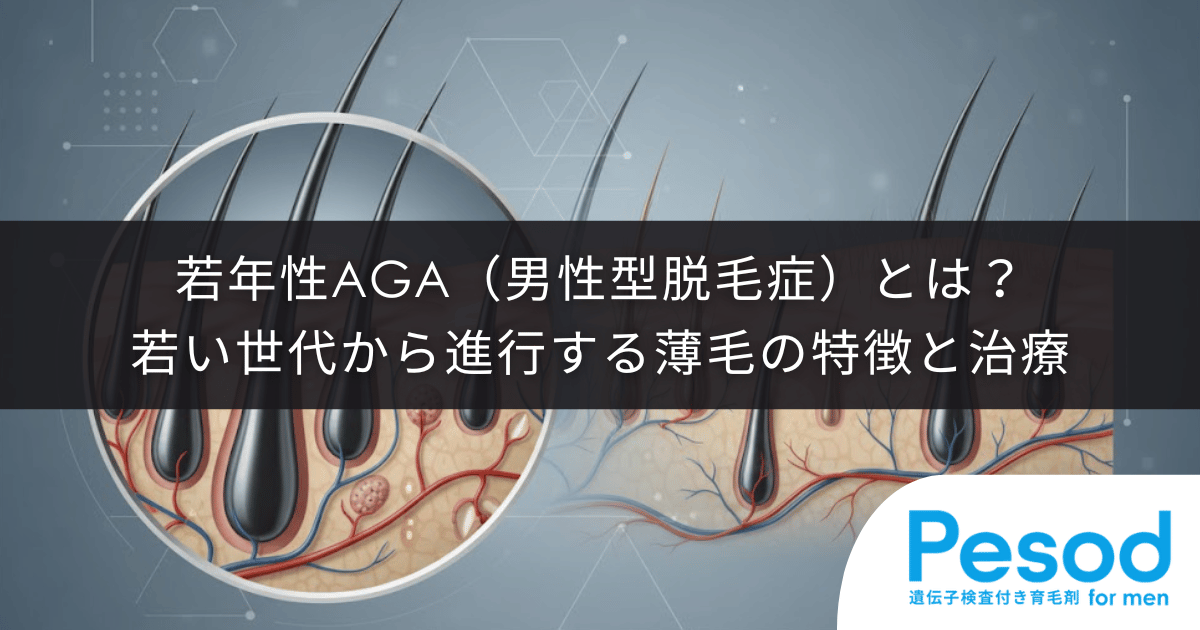若年性AGA（男性型脱毛症）とは？若い世代から進行する薄毛の特徴とクリニックでの治療