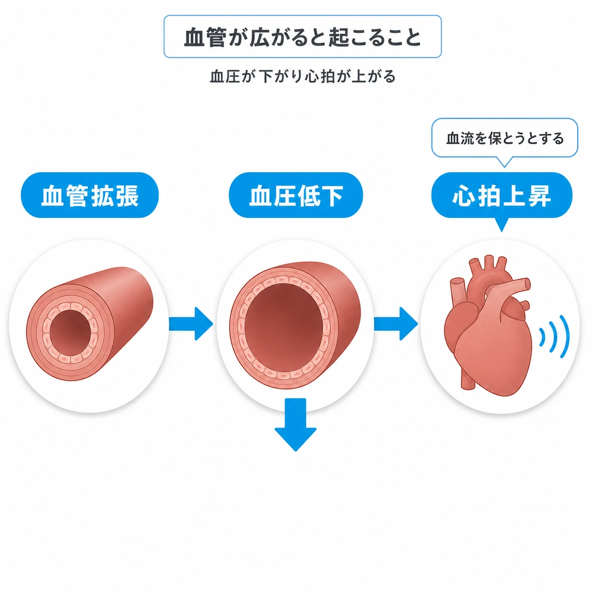 血管が広がって血圧が下がり心拍が速くなるまでの連鎖を3段階でつないだ医療イラスト