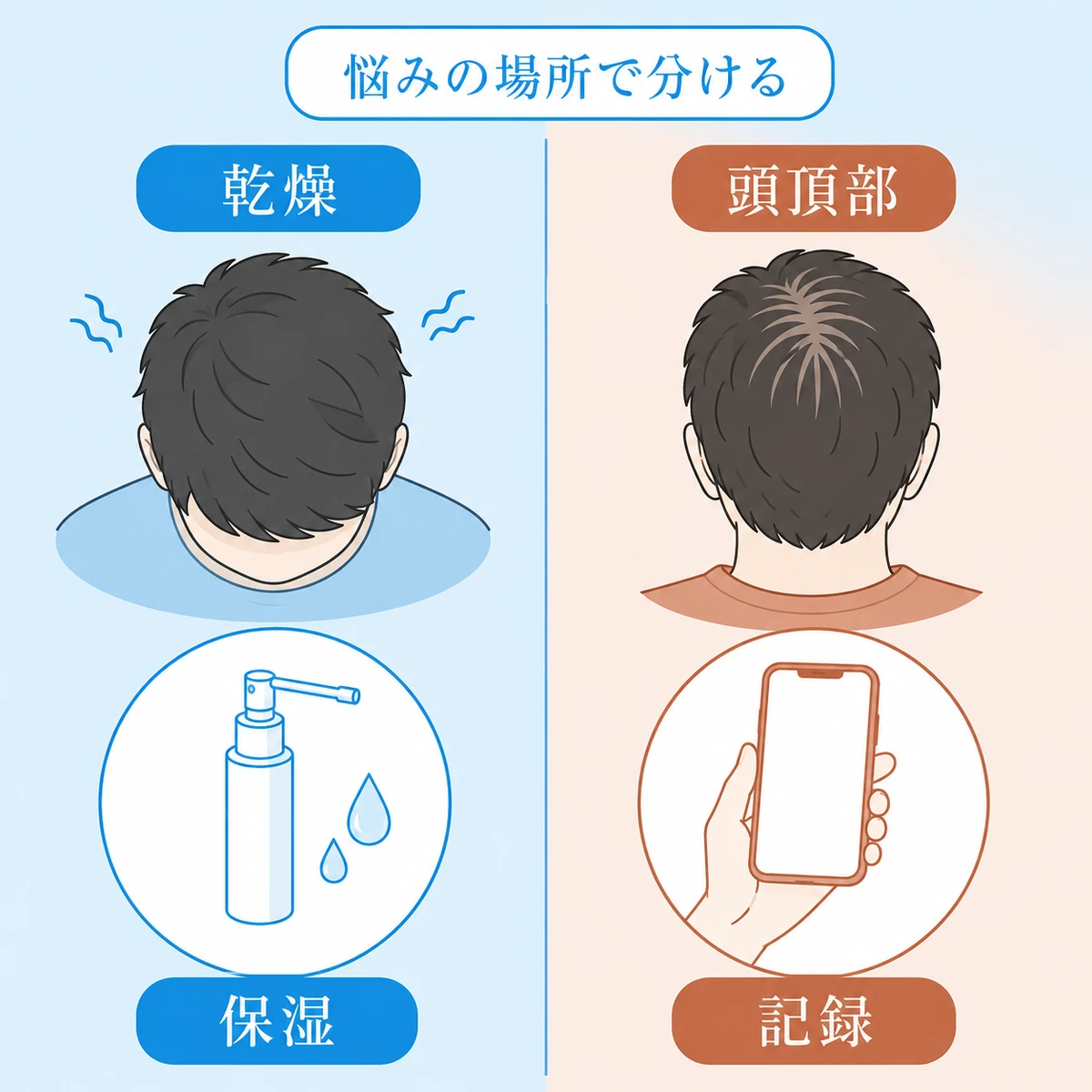 乾燥した頭皮には保湿、頭頂部の透けには記録という確認の分け方を描いた図