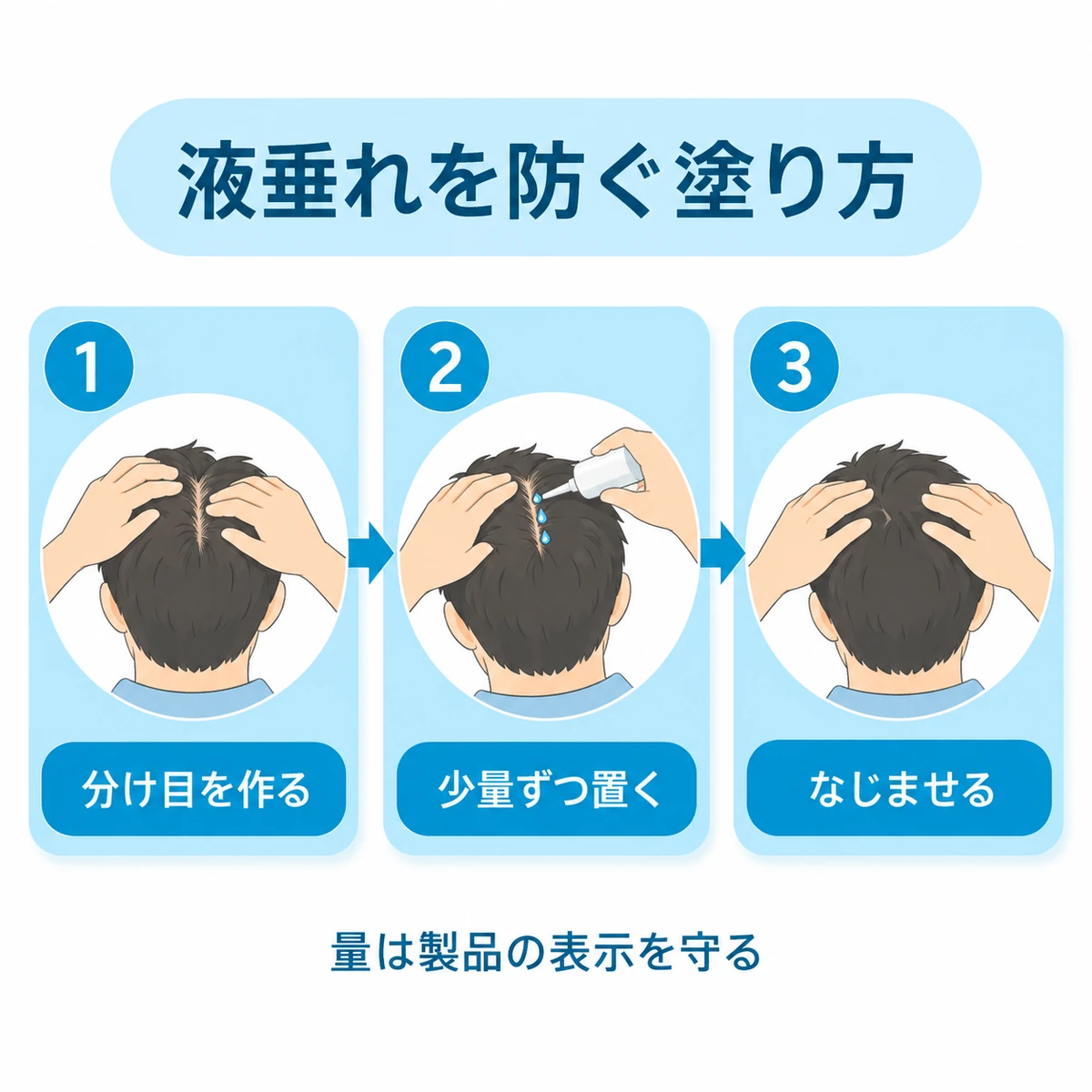 髪に分け目を作り、育毛剤を少量ずつ置いて指でなじませる手順図
