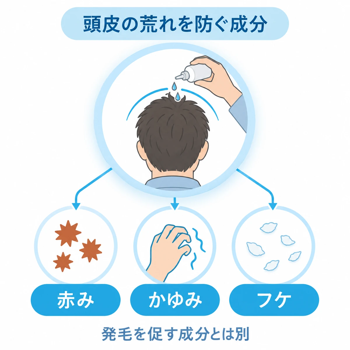 育毛剤を頭皮に塗る男性と、赤み・かゆみ・フケの3つの悩みを結んだ図