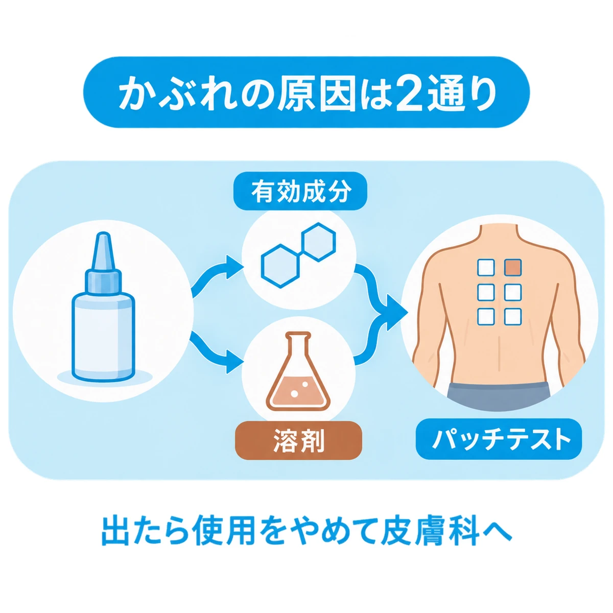 外用薬によるかぶれの原因候補を有効成分と溶剤に分け、パッチテストにつなげた流れ図